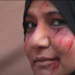 Pretendimi se palestinezët po maskohen si të plagosur nga sulmet izraelite, është i rremë (Video)